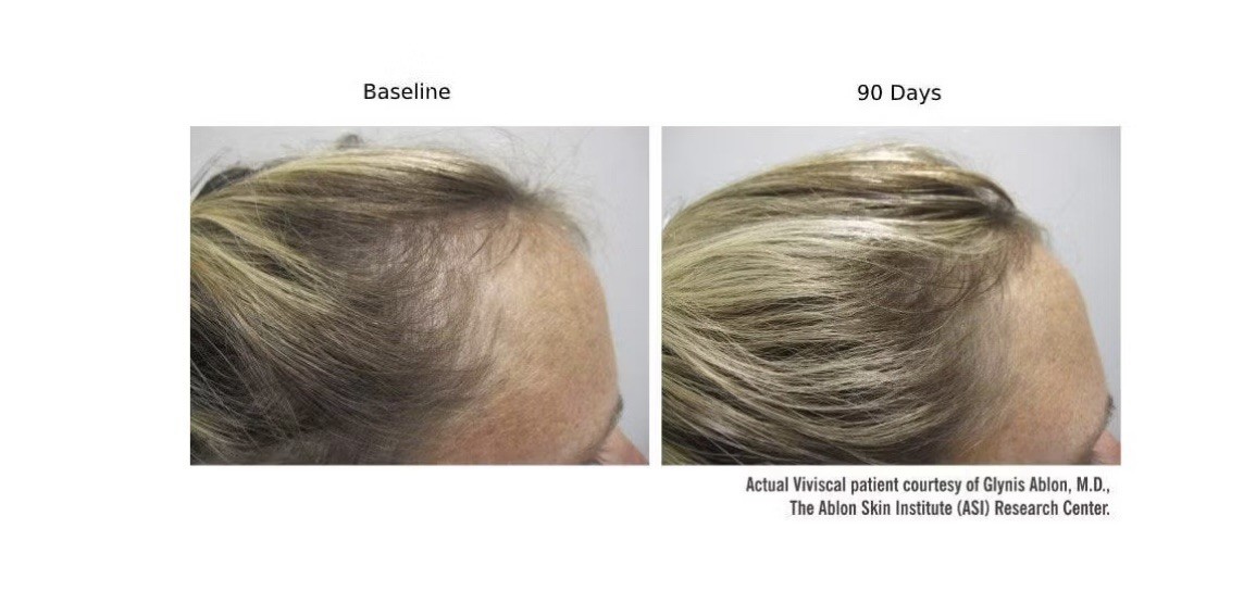 Viviscal Hair Growth Dietary Supplement with Collagen Complex 180