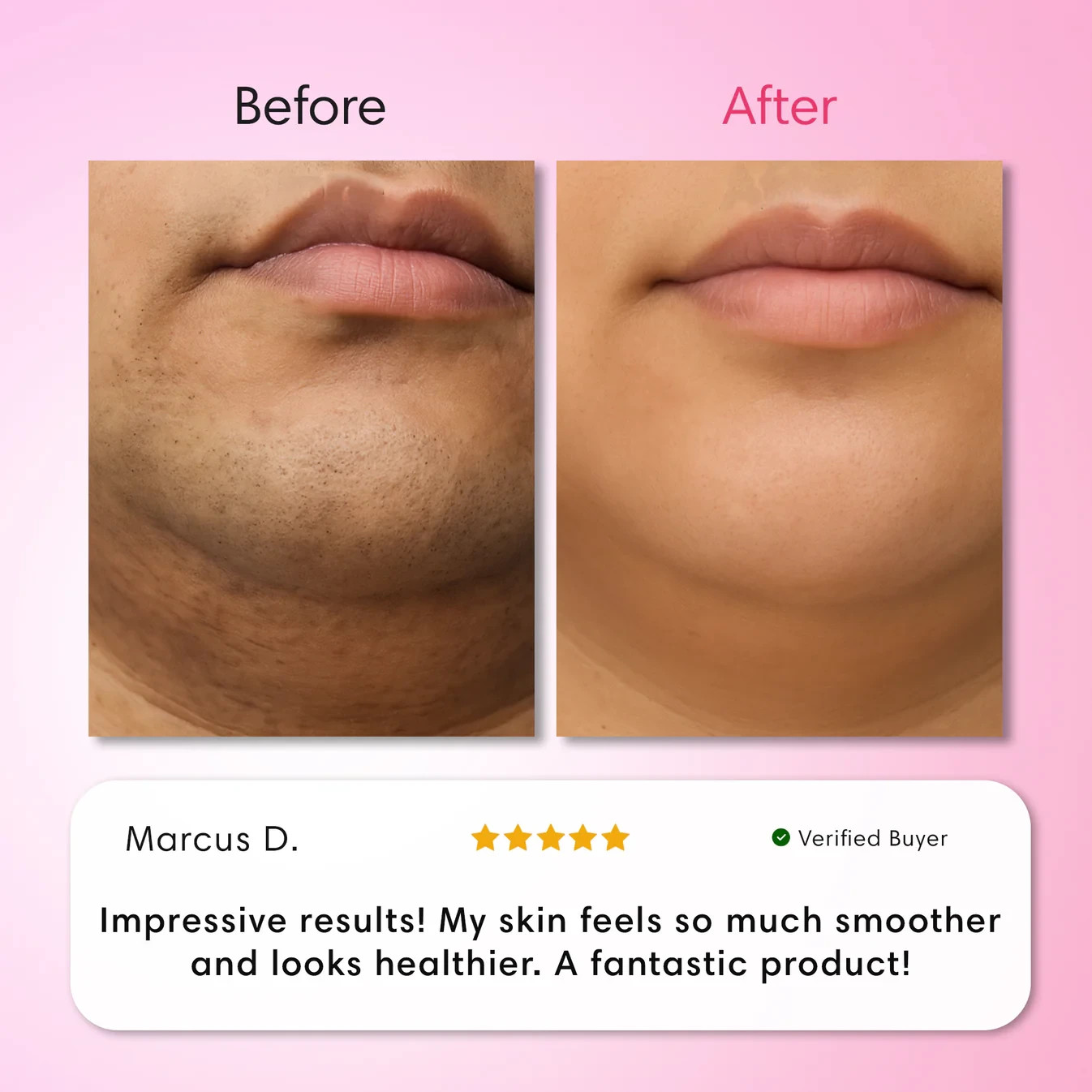 Auures Hair Removal Cream, Facial Cream Kit, Painless…