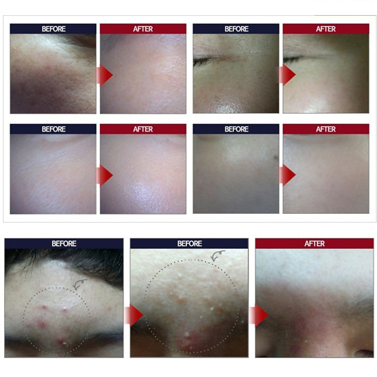 MIZON All In One Snail Repair Cream JIGOTT Snail Reparing Cream Anti-Aging Cream