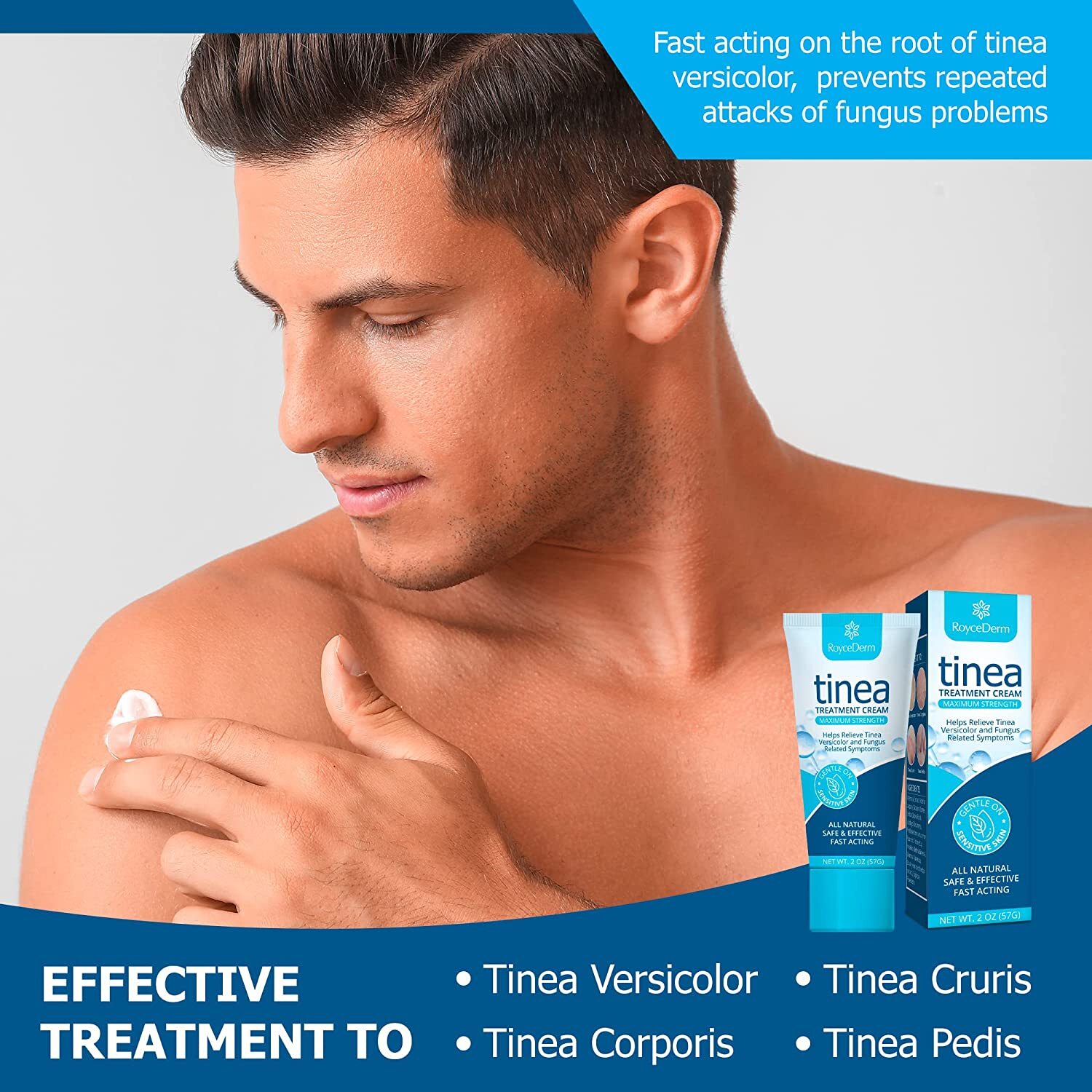 Roycederm Tinea Versicolor & Pedis Treatment, Antifungal Cream 2 Oz Exp 08/2024