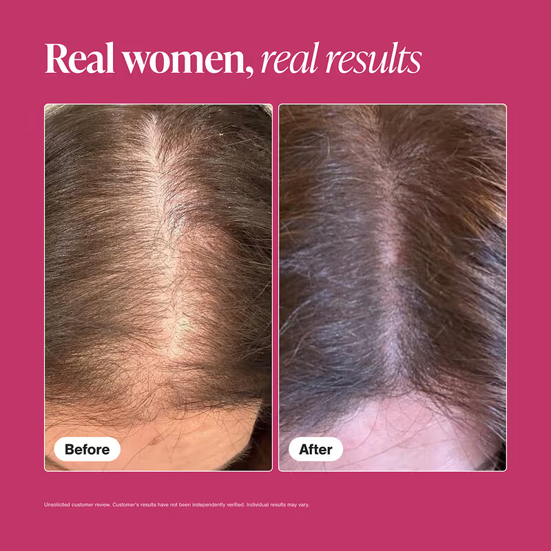 Viviscal Hair Growth Supplement for Women 180 Tablets – 3 Month Supply