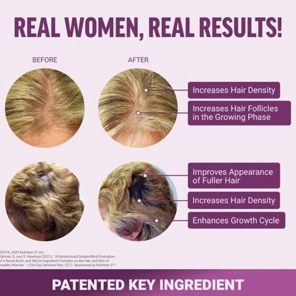 Force Factor Hair Growth Gummies – Supports hair growth and nourishes hair