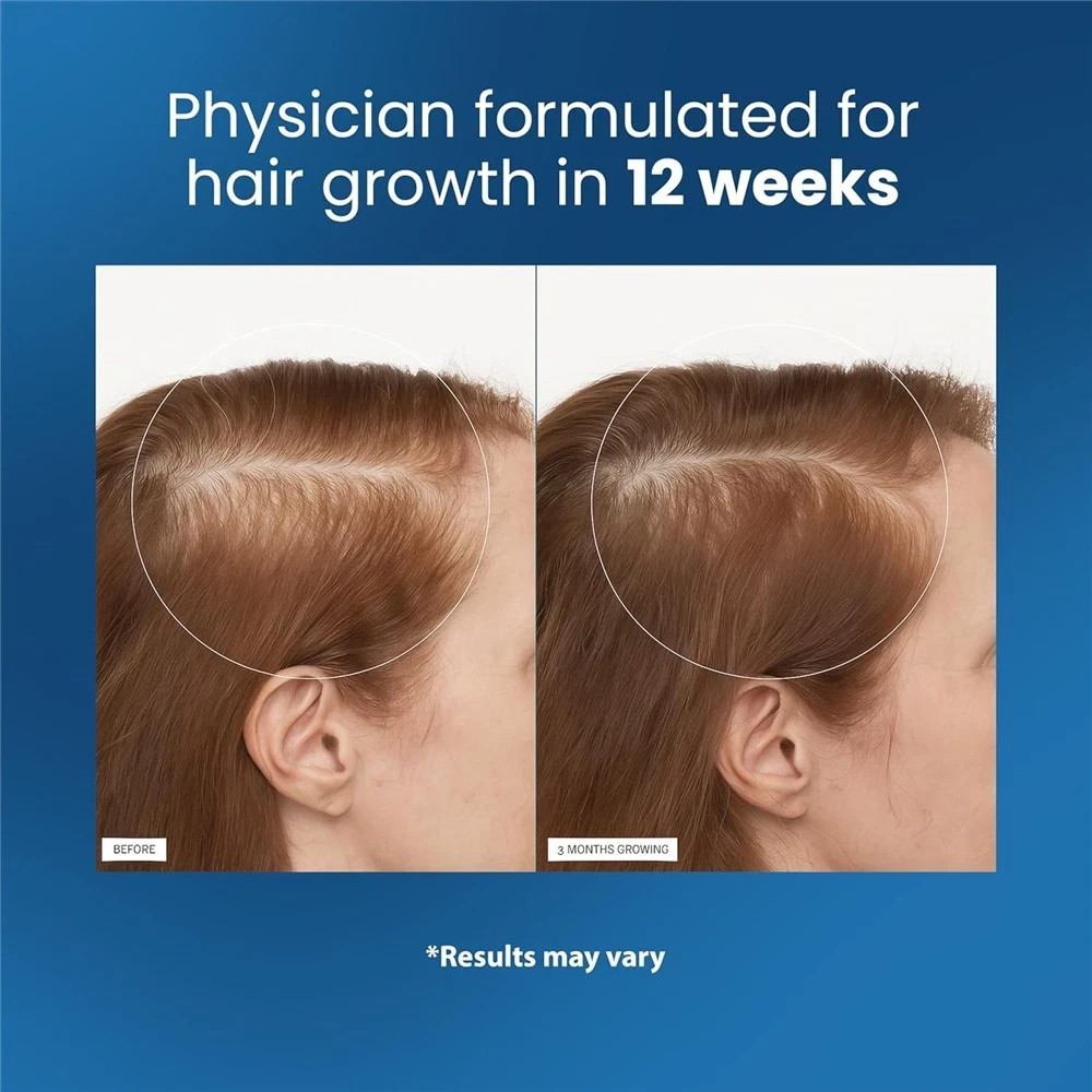 Be Bodywise Hair Growth Serum Roll On – 3% Rosemary, 3% Redensyl & 2% – 2025🔥