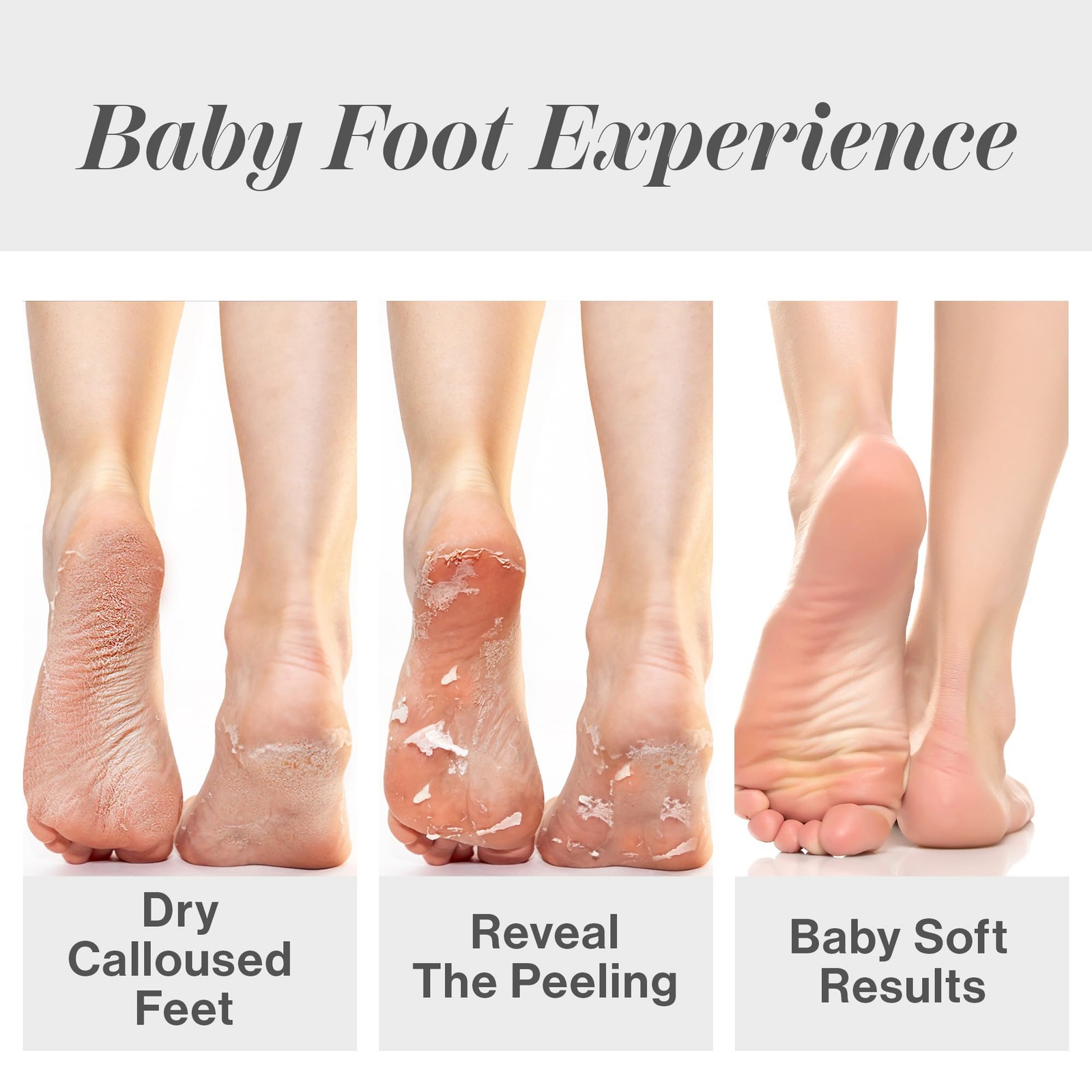 Baby Foot Original Exfoliation Peel – For 2.4 Fl Oz (Pack of 1), Purple