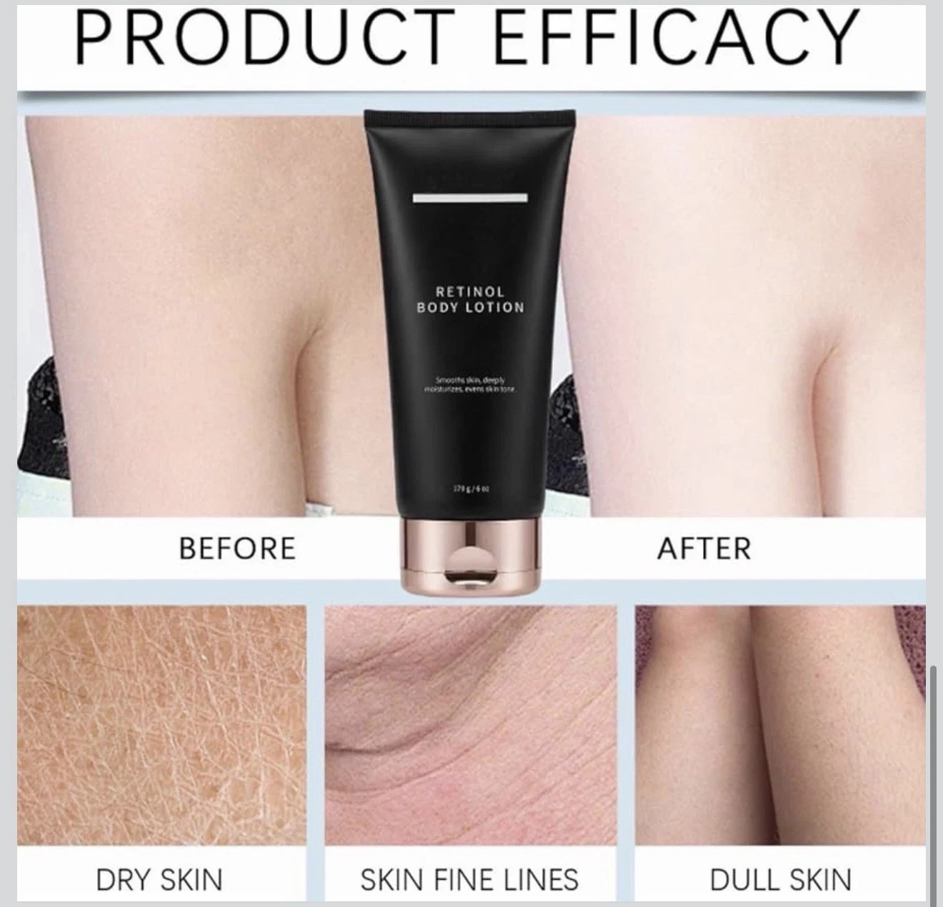 Retinol Anti Aging Body Lotion Firming Cream Crepey Skin Moisturizer 6oz 170g