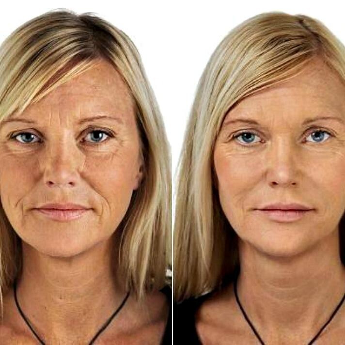 Retinol + Collagen, Hyaluronic Acid, Vitamin C AntiAging Wrinkle Serum Cream 4oz
